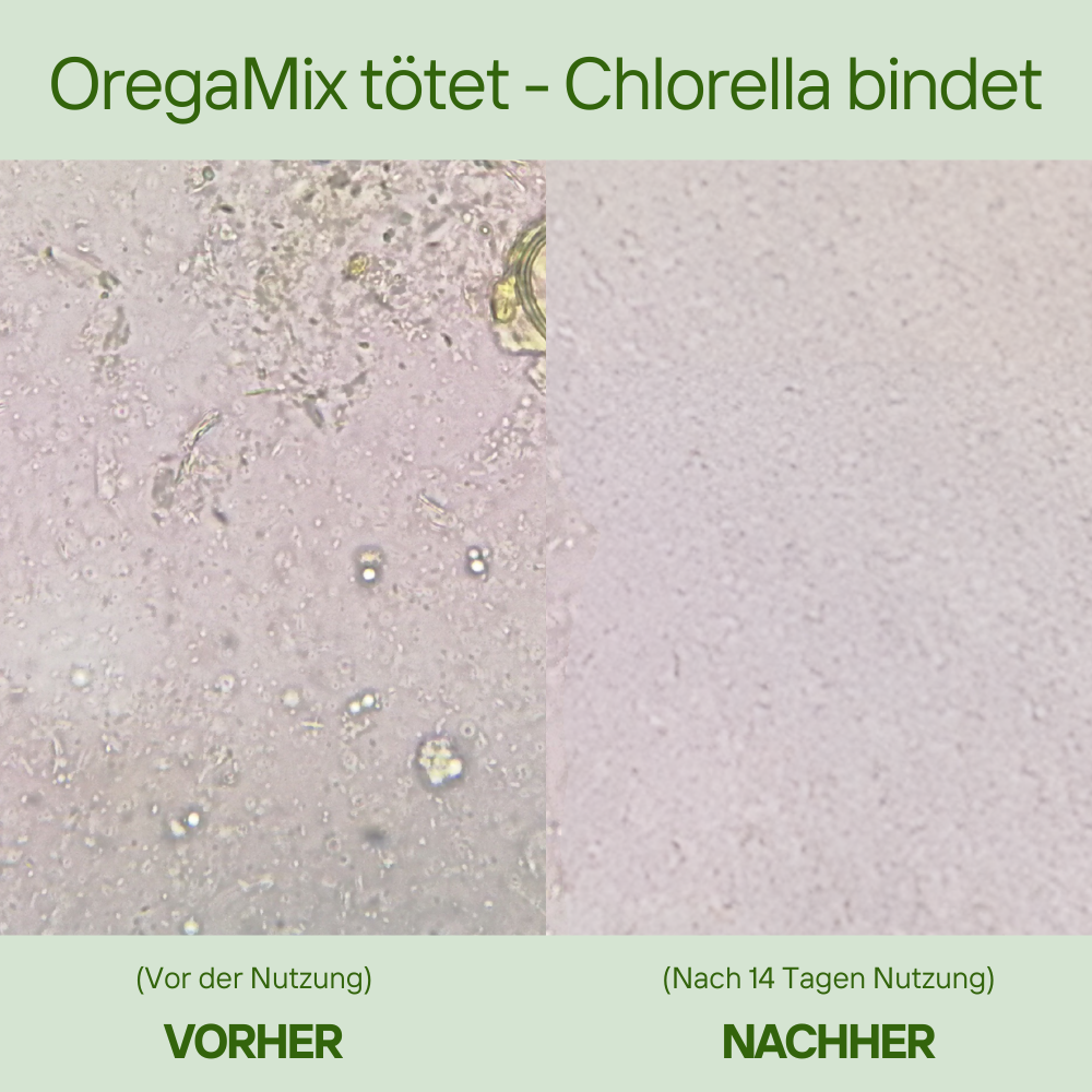 Alimora - Parasiten Detox Bundle