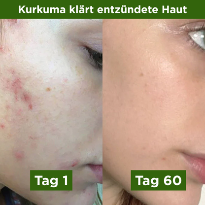 Alimora - Kurkuma Gummies