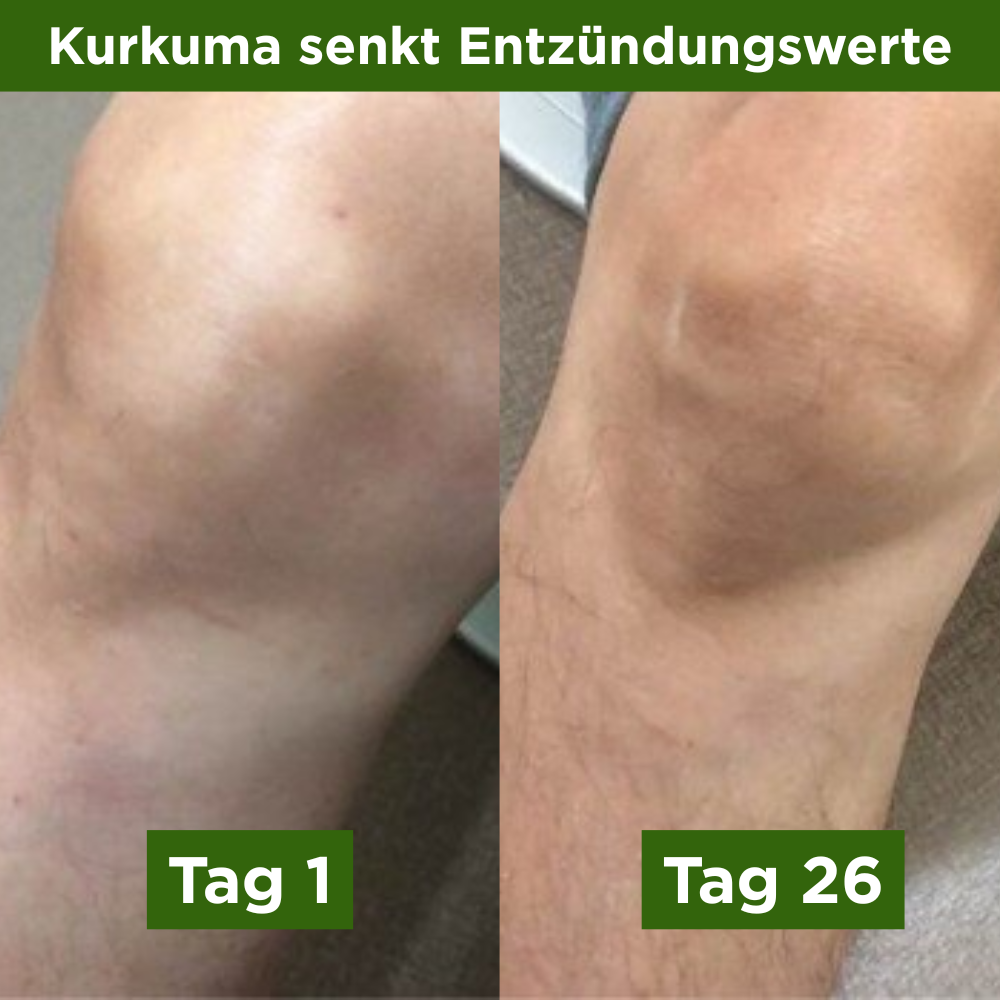 Alimora - Kurkuma Gummies